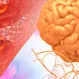 What Is Metabolic Encephalopathy?